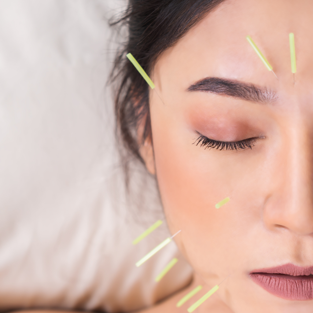 eye rejuvenation acupuncture 