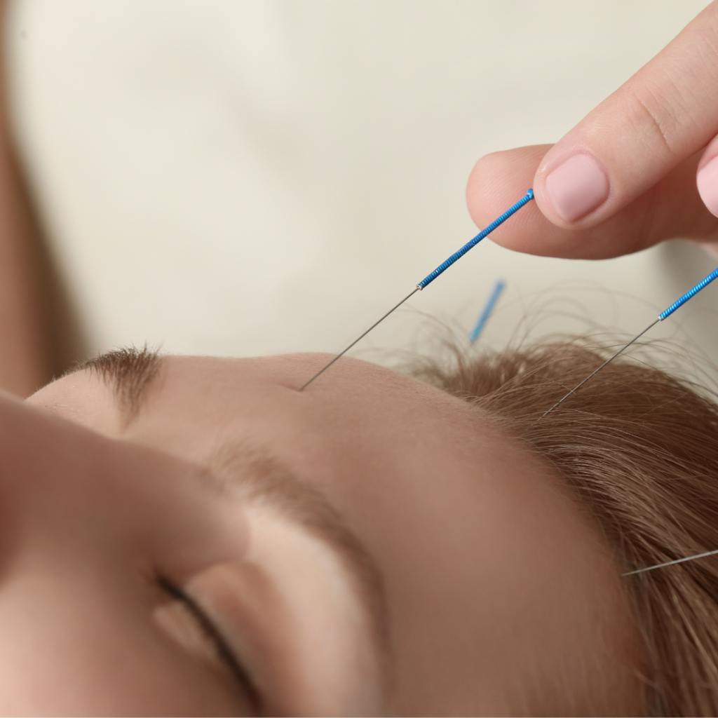 eye rejuvenation acupuncture